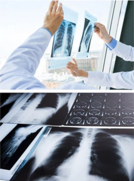 China Veterinary X-ray Machine China Veterinary X-ray Machine